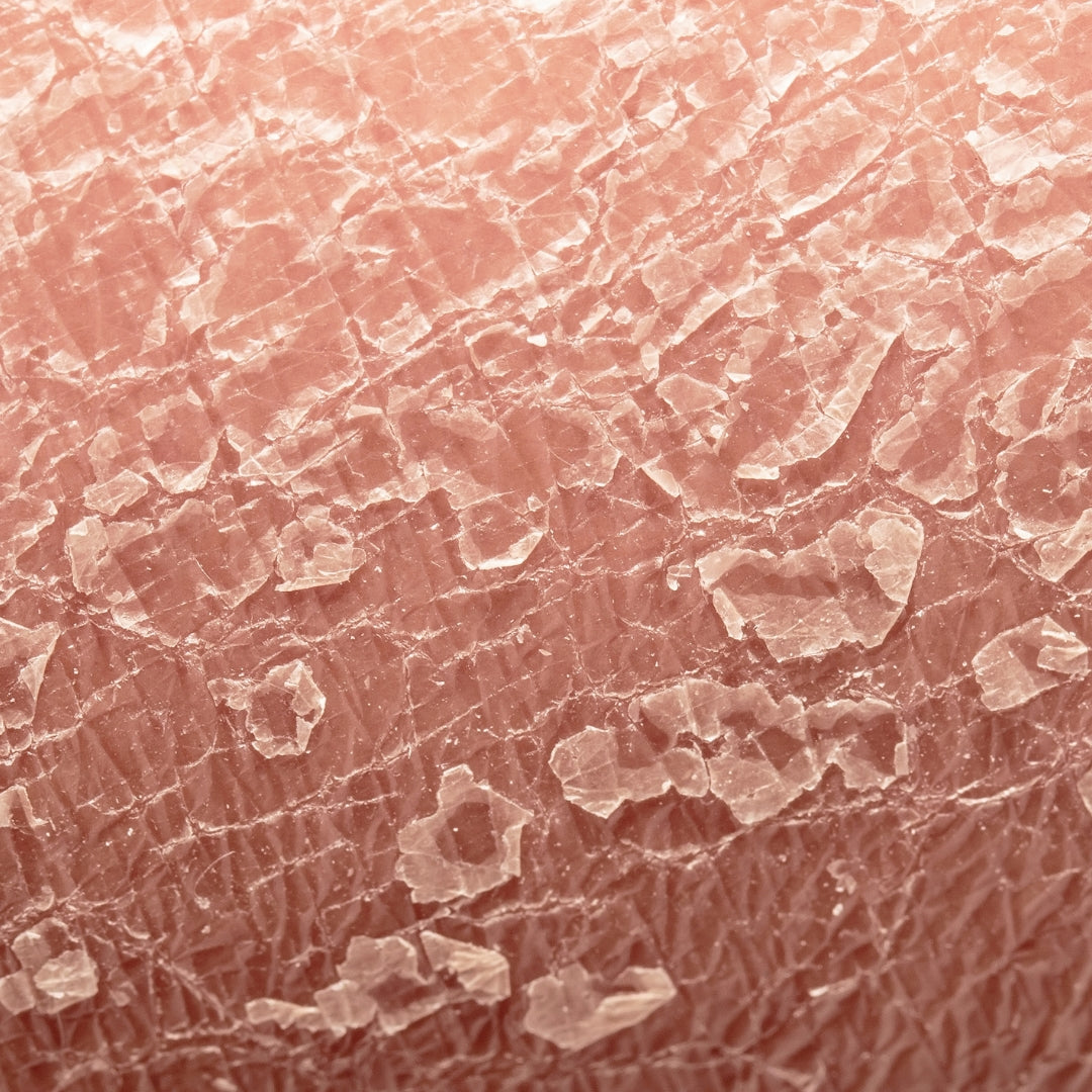 18 of Nature's Finest Remedies For Troubled Skin