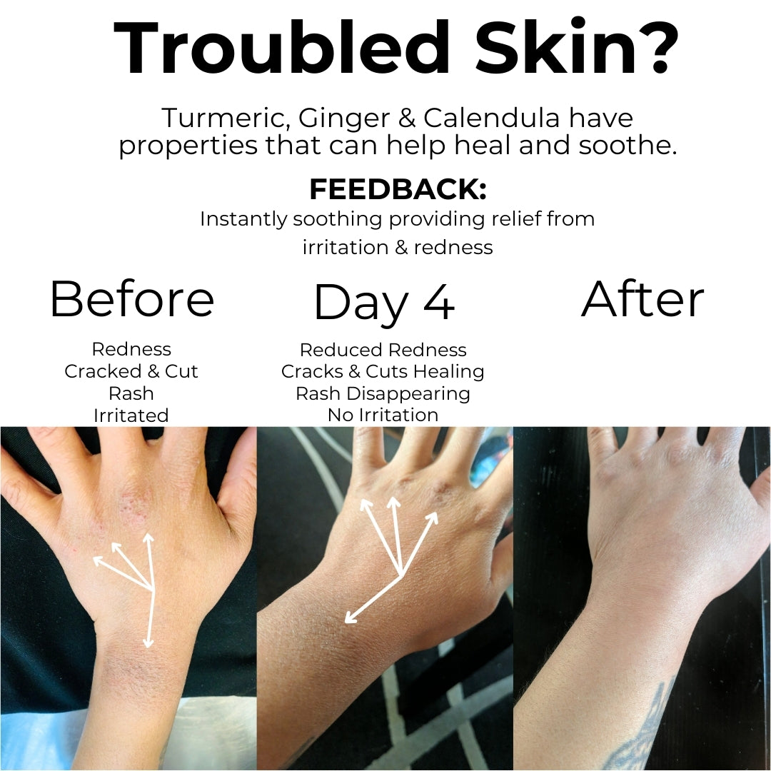 TURMERIC GINGER CALENDULA SET