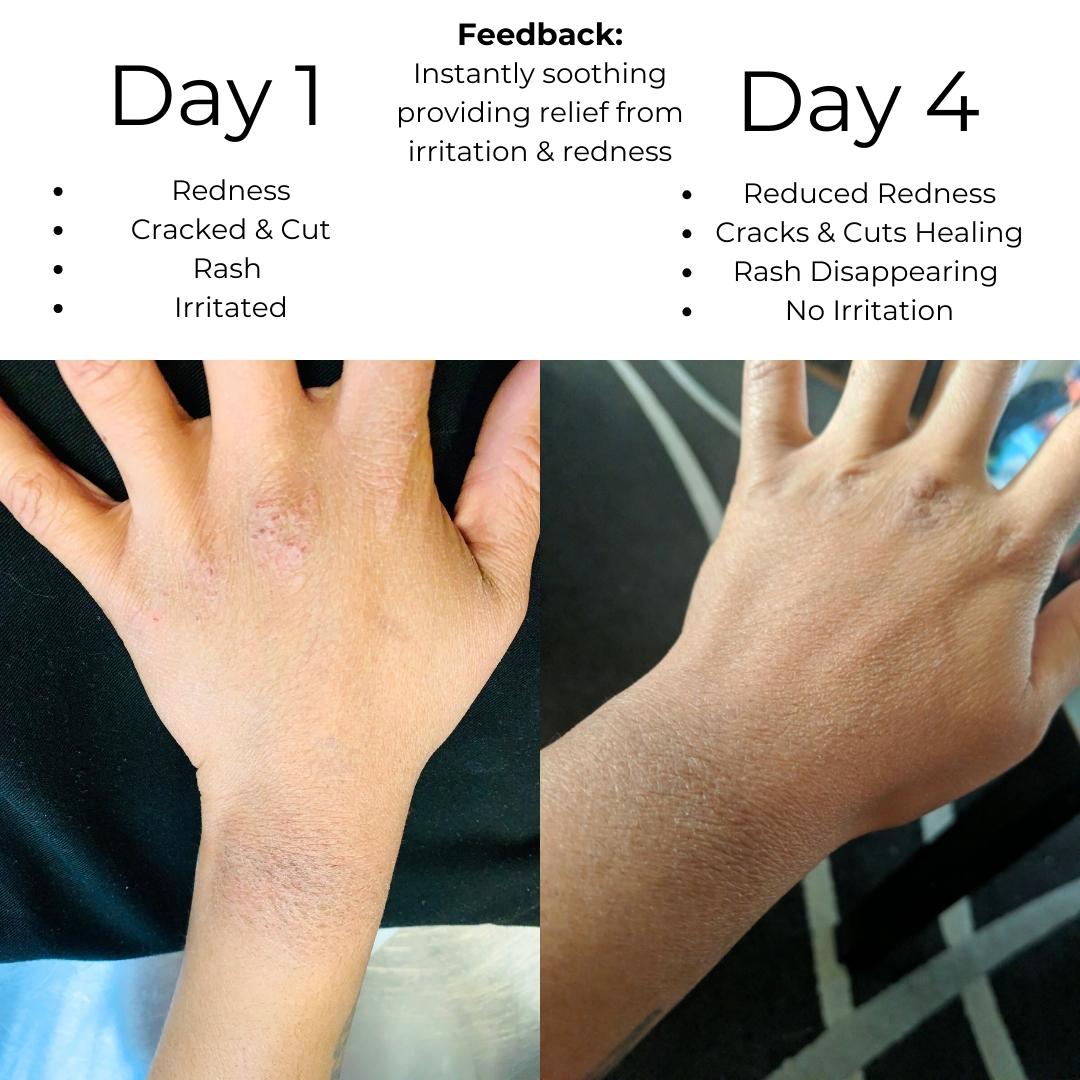 TURMERIC GINGER CALENDULA MOISTURIZING BODY LOTION